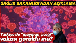 Sağlık Bakanlığı'ndan "maymun çiçeği" açıklaması!