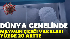 Maymun çiçeği vakaları yüzde 20 arttı!