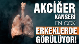 Akciğer kanseri en çok erkeklerde görülüyor