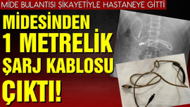 Midesinden 1 metrelik şarj kablosu çıktı!