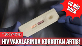 Türkiye'de HIV vakalarında korkutan artış!