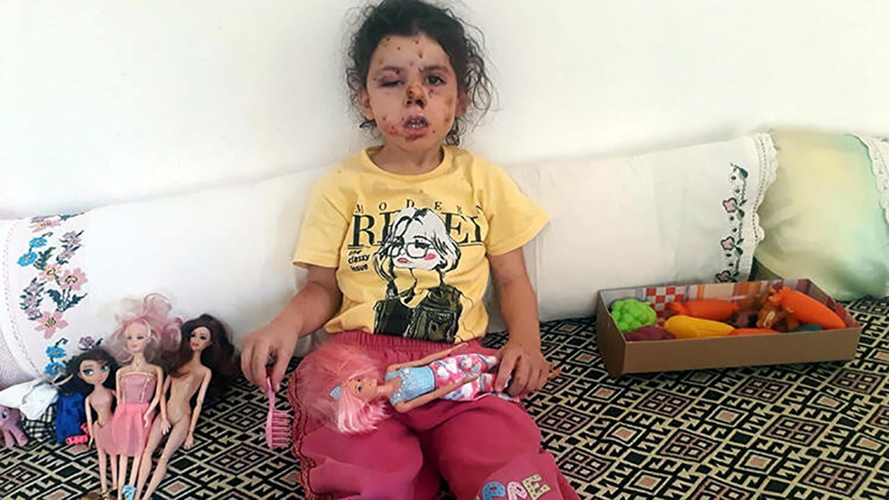 İzmir'de balkonda oturan Neriman yaralandı