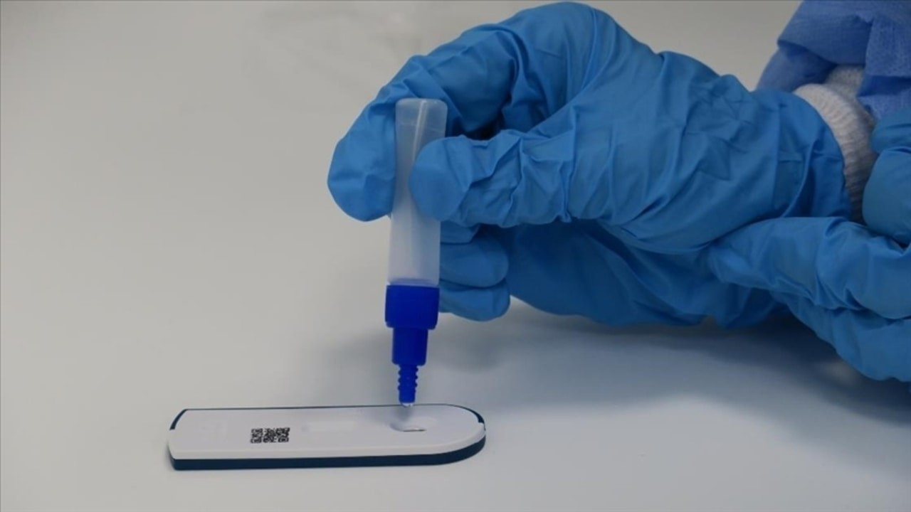 Yerli firma Kovid-19 antijen testi üretti