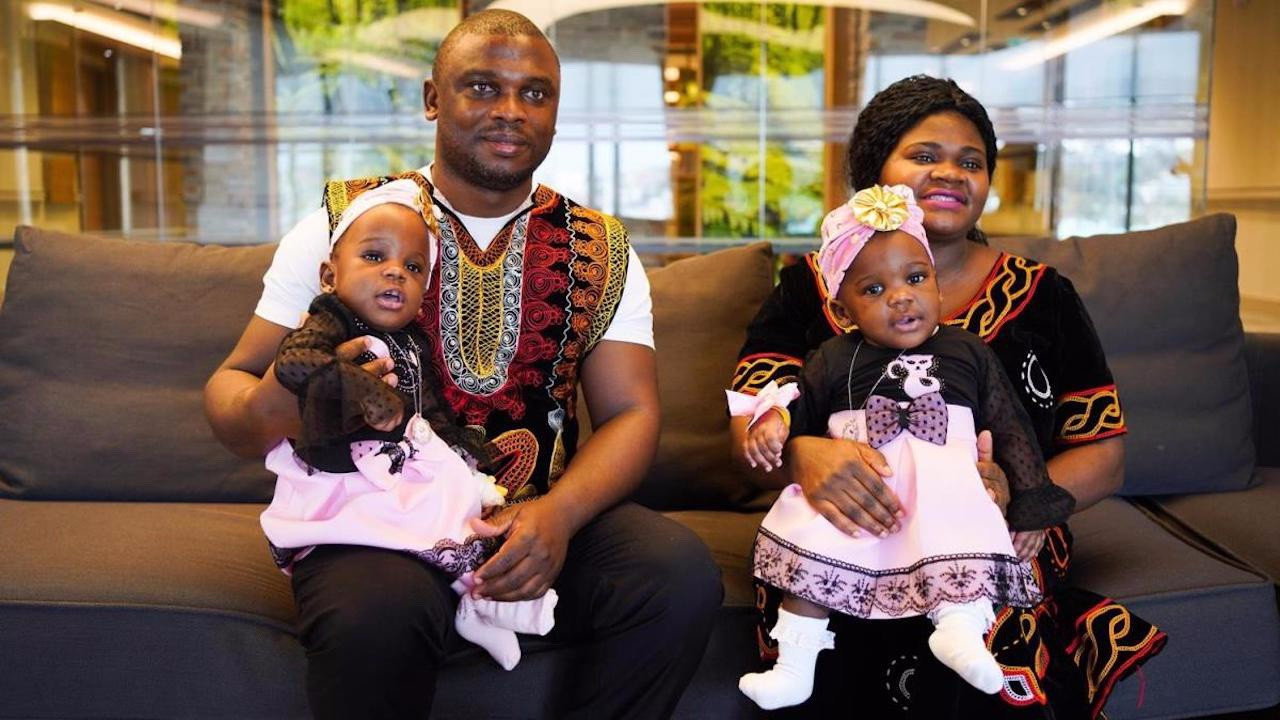 Kamerun'lu siyam ikizleri, Türkiye'de şifa buldu