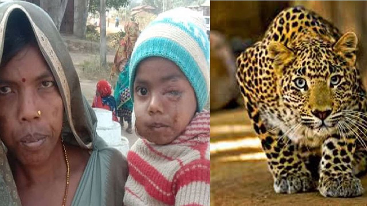 Bir anne, oğlunu leoparın pençelerinden kurtardı