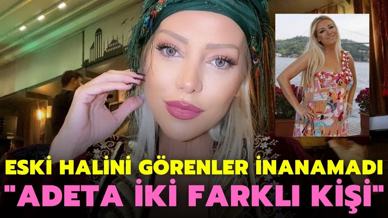 Gülşah Saraçoğlu'nun eski hali