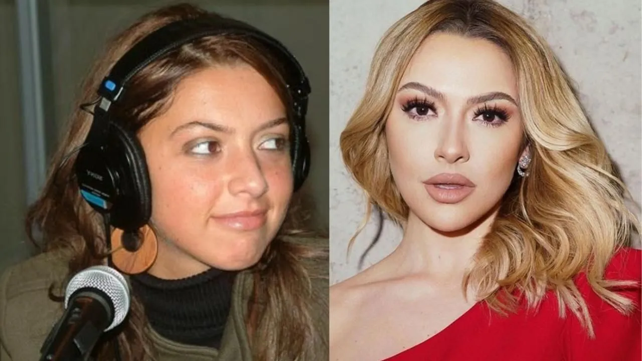 Ünlülerin eski ve yeni halleri! Çok şaşıracaksınız