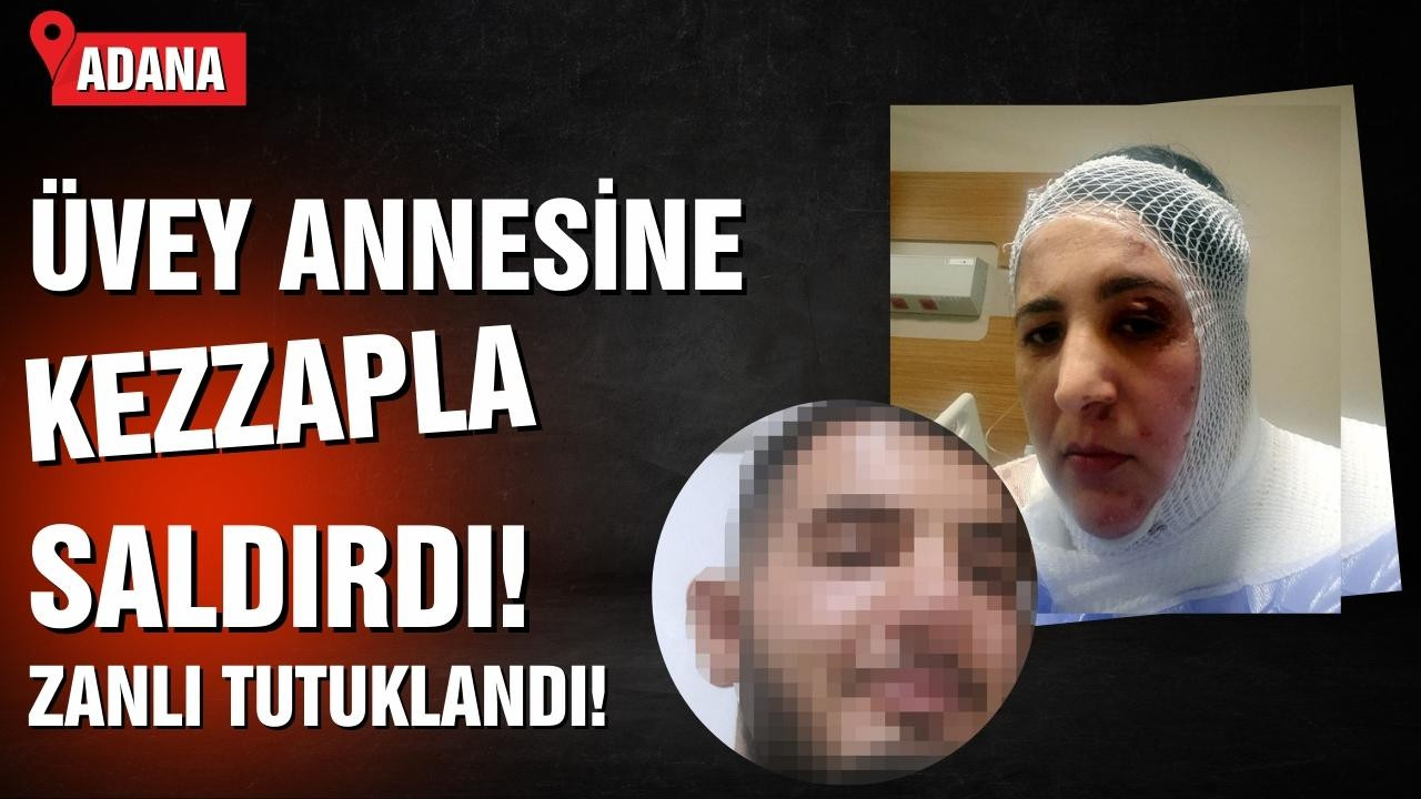 Üvey annesine kezzapla saldırdı!