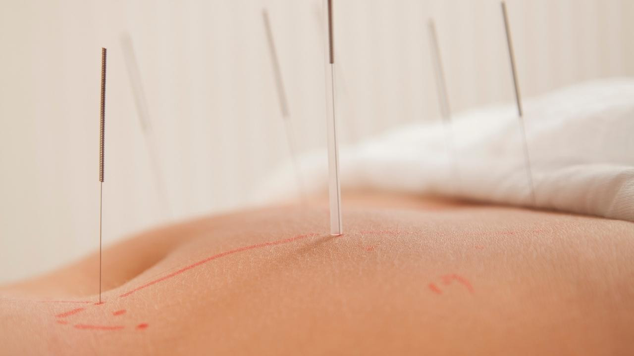 Yüz felcinden akupunkturla kurtuldu