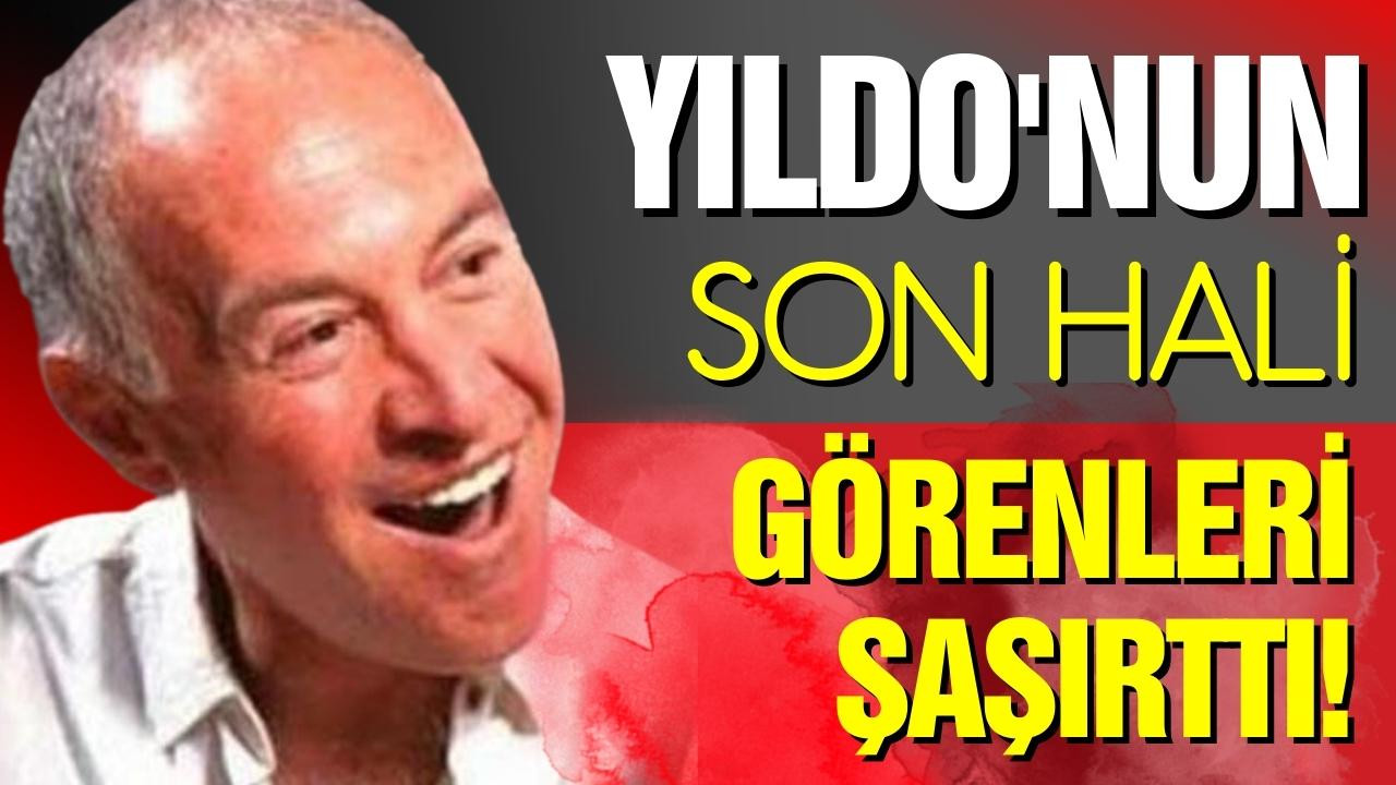 Yıldo'nun son hali görenleri şaşırttı