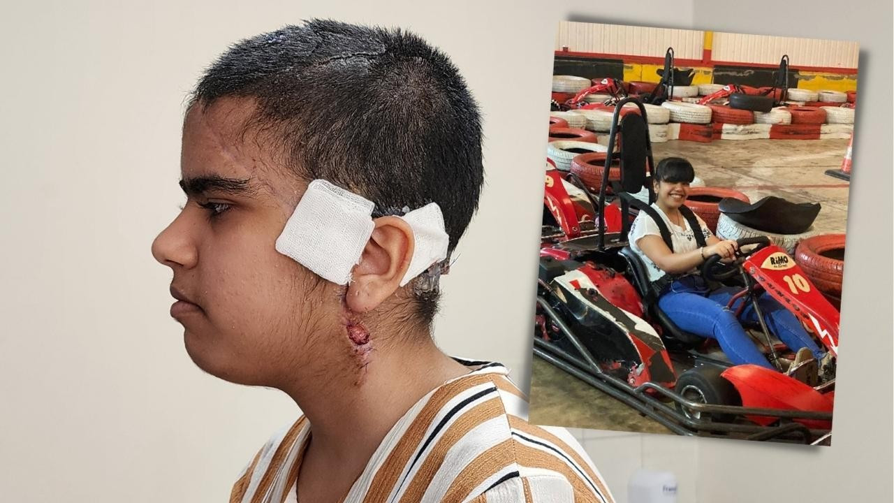 Go-kart aracına saçını kaptırdı, ölümden döndü!