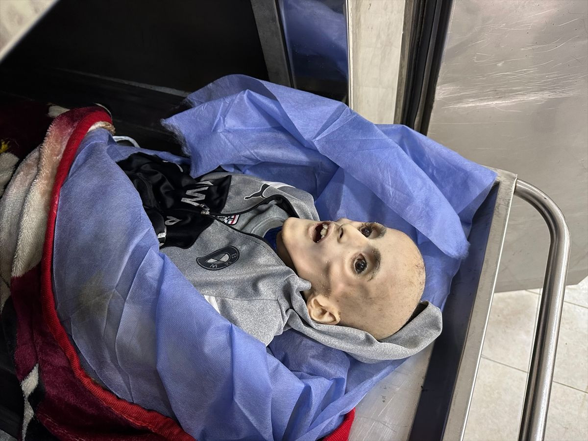 Gazze'de 10 yaşındaki çocuk yetersiz beslenme nedeniyle hayatını kaybetti - Sayfa 6