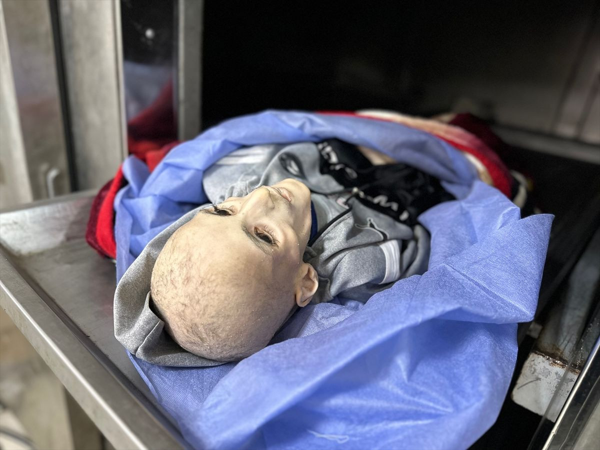 Gazze'de 10 yaşındaki çocuk yetersiz beslenme nedeniyle hayatını kaybetti - Sayfa 7