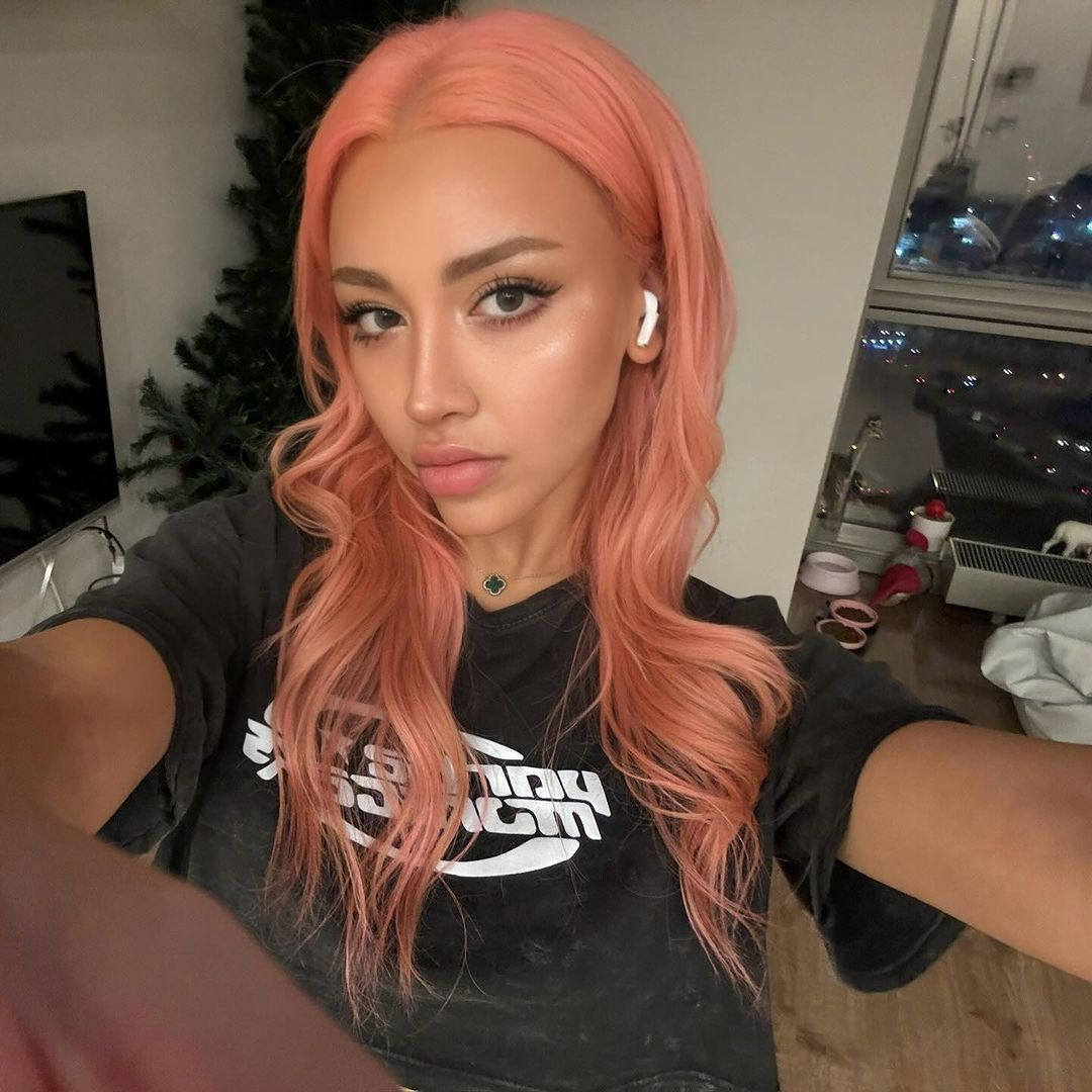 Sosyal medya fenomeninin değişimi akıllara durgunluk verdi! - Sayfa 7