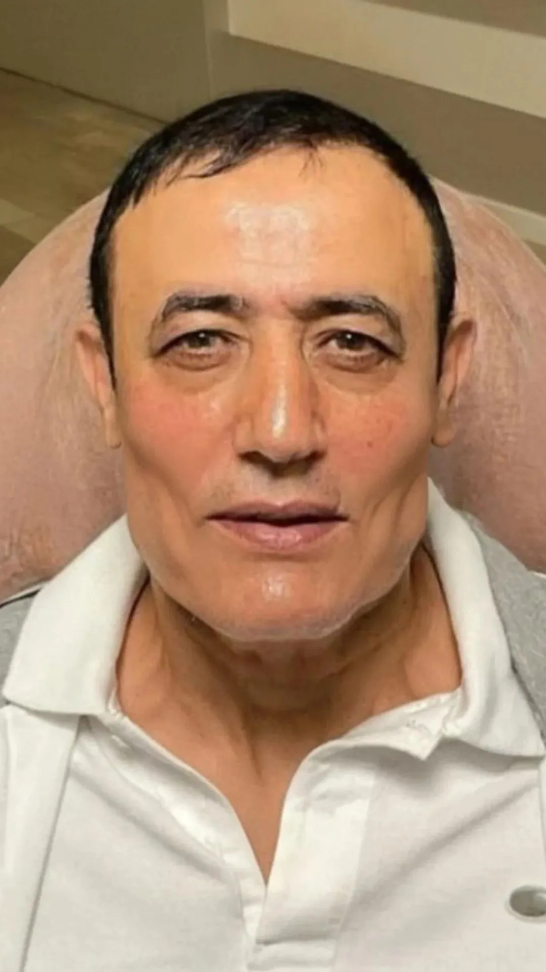 Estetikliler kervanına ünlü şarkıcı Mahmut Tuncer de katıldı! Tuncer, 10 yaş gençleşti