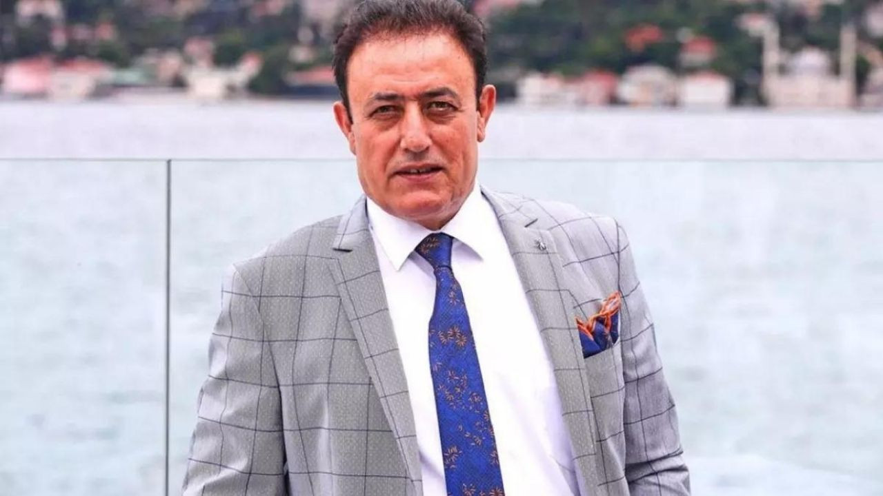 Estetikliler kervanına ünlü şarkıcı Mahmut Tuncer de katıldı! Tuncer, 10 yaş gençleşti - Sayfa 5