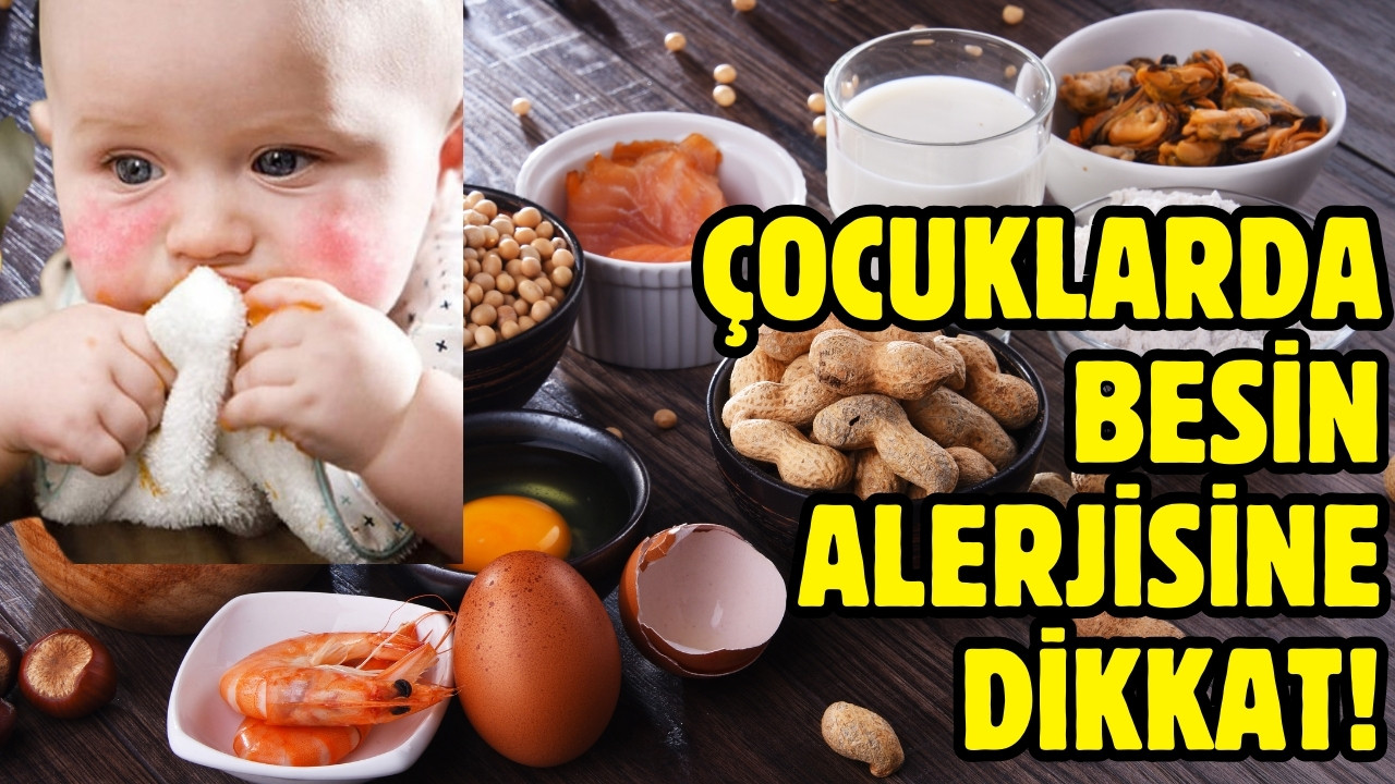 Çocuklarda besin alerjisi arttı!