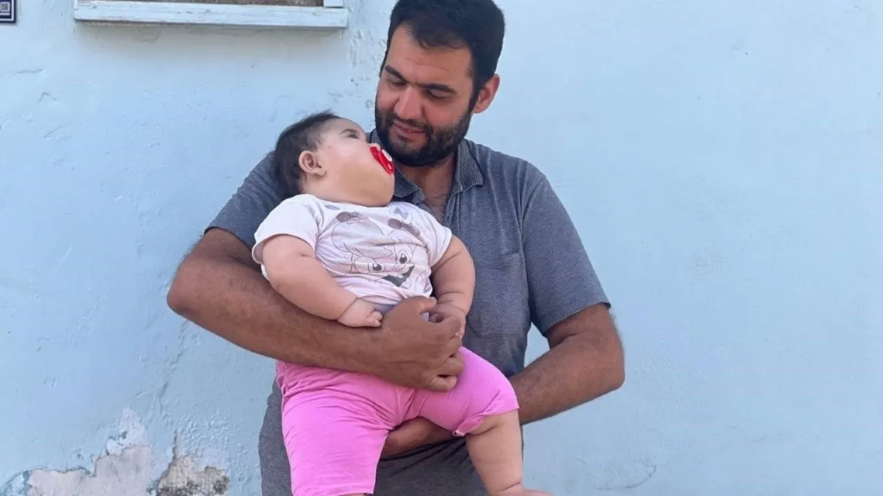 Şanlıurfa’da 11 aylık bebek 20 kiloyu geçti!